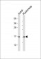 EMP3 Antibody (C-term)