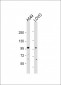 EPS8 Antibody (N-term)