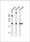 SFTPC Antibody (N-term)