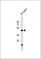 DRG1 Antibody (C-term)