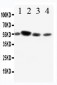 Anti-CD89 Antibody