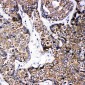 Anti-ABCB6 Antibody