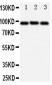 Anti-ABCB6 Antibody