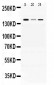 Anti-ADAMTS13 Picoband Antibody