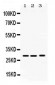 Anti-PSMA3 Picoband Antibody