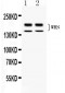 Anti-WRN Picoband Antibody