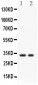 Anti-SFRP2 Picoband Antibody