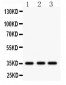 Anti-IGFBP2 Picoband Antibody