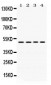 Anti-DDB2 Picoband Antibody