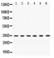 Anti-SULT2A1 Picoband Antibody