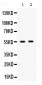 Anti-SMYD3 Picoband Antibody