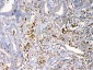 Anti-Psoriasin Picoband Antibody