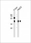 ASGR1 Antibody (N-term)