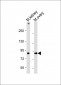 Mouse Fap Antibody(N-term)