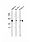 LECT1 Antibody (N-term)