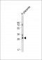 DIO3 Antibody (C-term)