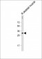 DIO3 Antibody (C-term)