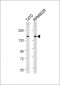 ABCC12 Antibody (Center)