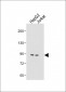 MGAT5 Antibody (C-term)