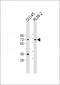 DDX53 Antibody (C-term)