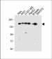 RECQL4 Antibody(C-term)