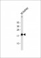 NDUFS4 Antibody (C-term)