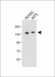 TECPR1 Antibody (C-term)