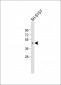 TSPYL5 Antibody (C-term)