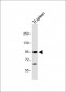 CBLB Antibody (Center)