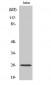 C1q-B Polyclonal Antibody