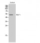 Dok-1 Polyclonal Antibody