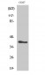 MVK Polyclonal Antibody