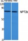 NPT2b Polyclonal Antibody