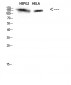 IRS2 Polyclonal Antibody