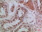 Tubulin γ Polyclonal Antibody