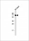 DPEP2 Antibody (Center)