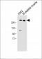 ADAMTS13 Antibody (Center)