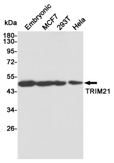 TRIM21 (5B9) Mouse mAb