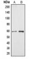 Anti-Cytochrome P450 4A11/22 Antibody