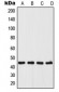 Anti-UGCG Antibody