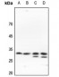 Anti-SLC25A11 Antibody