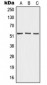 Anti-Angiopoietin-4 Antibody