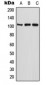 Anti-ETAA1 Antibody