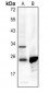 Anti-p22 phox Antibody