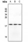 Anti-GADD45 beta Antibody