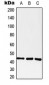 Anti-GPR182 Antibody