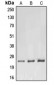 Anti-RhoF Antibody