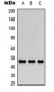 Anti-AChE Q Antibody