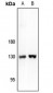 Anti-ARHGAP20 Antibody