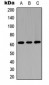 Anti-GGT5 HC Antibody